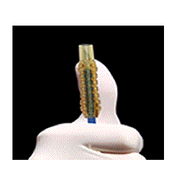 Paracentesis Microsurgical Knife Angled